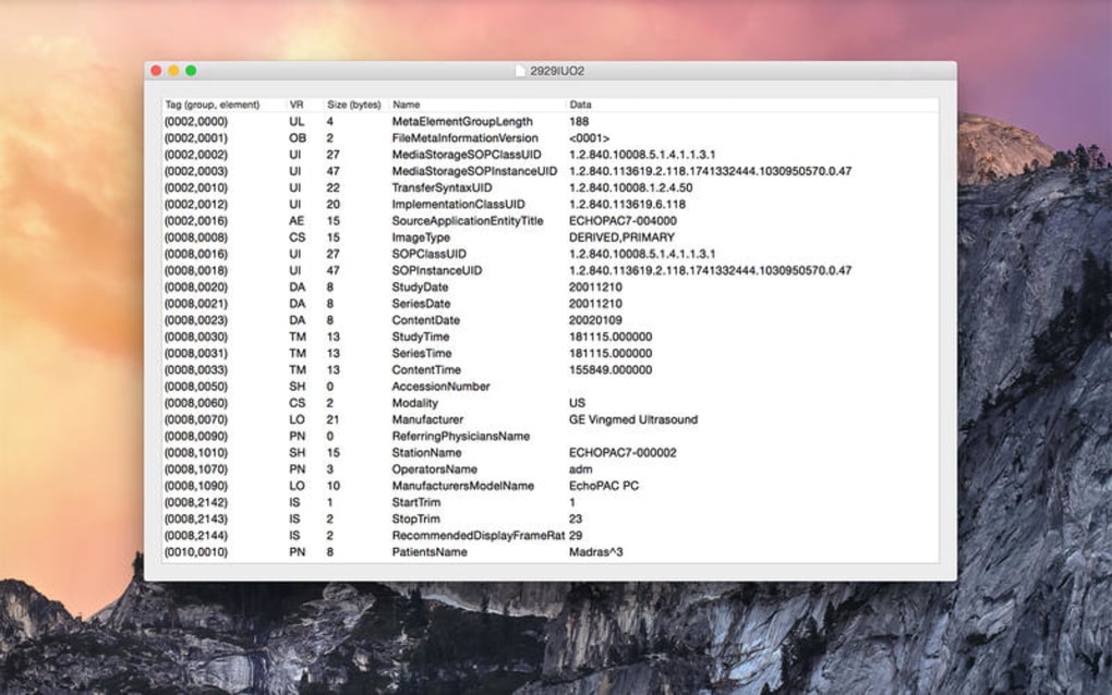 instal the new for mac Sante DICOM Editor 10.0.1